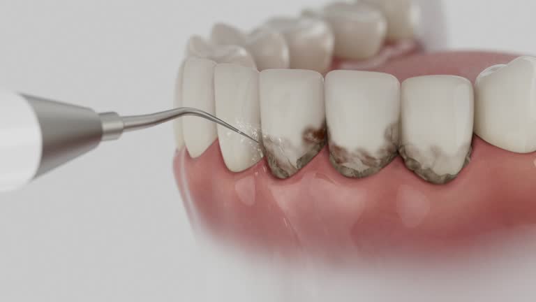 Trusted Teeth Cleaning And Checkup service in Swedesboro, NJ - Dentist Open Now